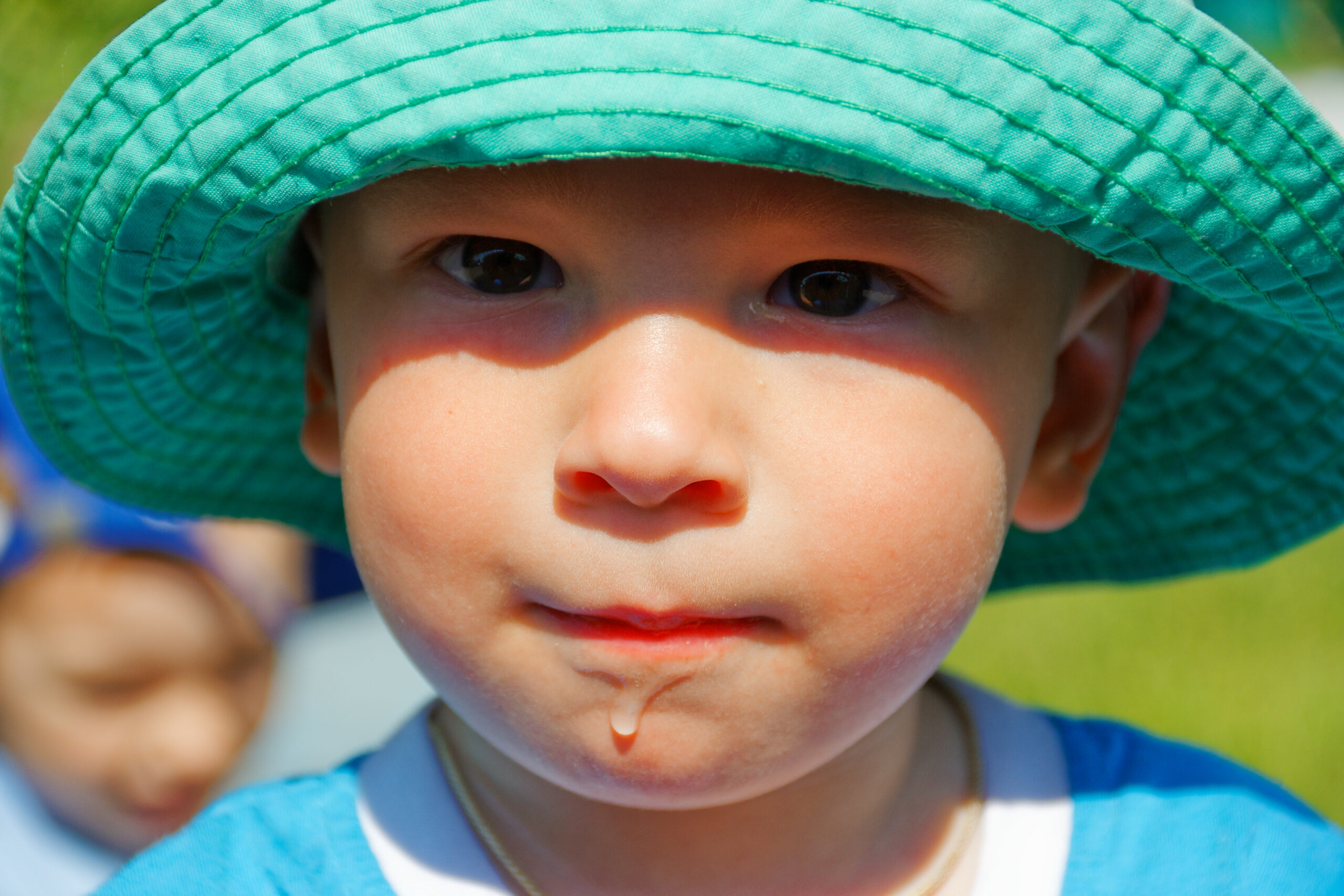 Saliva Control (Drooling/ Dribbling)